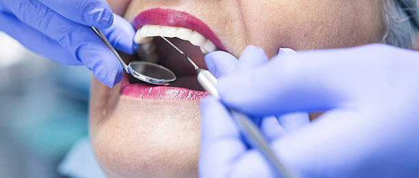 Best Emergency Wisdom Tooth Extraction in Manhattan, KS